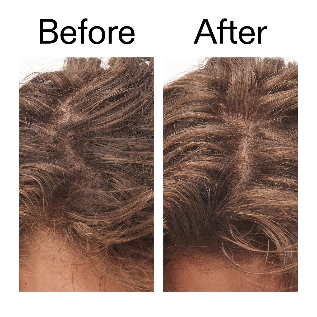 glycolic-acid-exfoliating-scalp-scrub-w4 Glycolic_Acid_Exfoliating_Scalp_Scrub_Before_After_2000x2000_b8561c87-05a1-4caa-80f7-1b6b33d750f7.jpg
