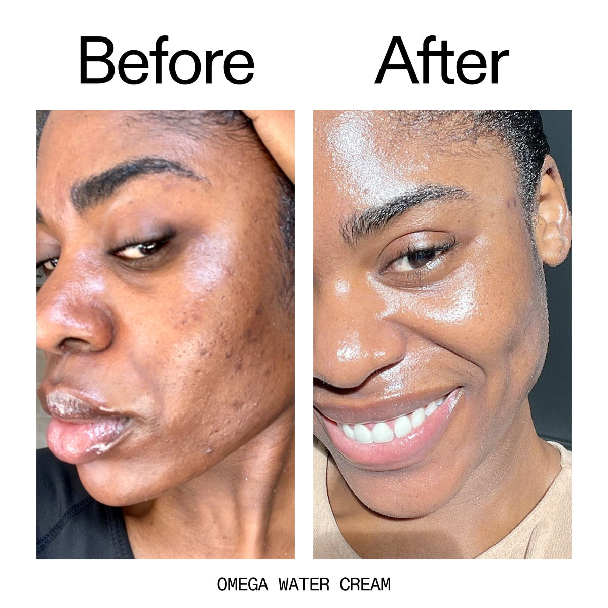 glowing-skin-set-i4 Omega_Water_Cream_Before_After_2000x2000_8e88278b-8c8d-48dc-ac77-4e98ebbd1b77.jpg