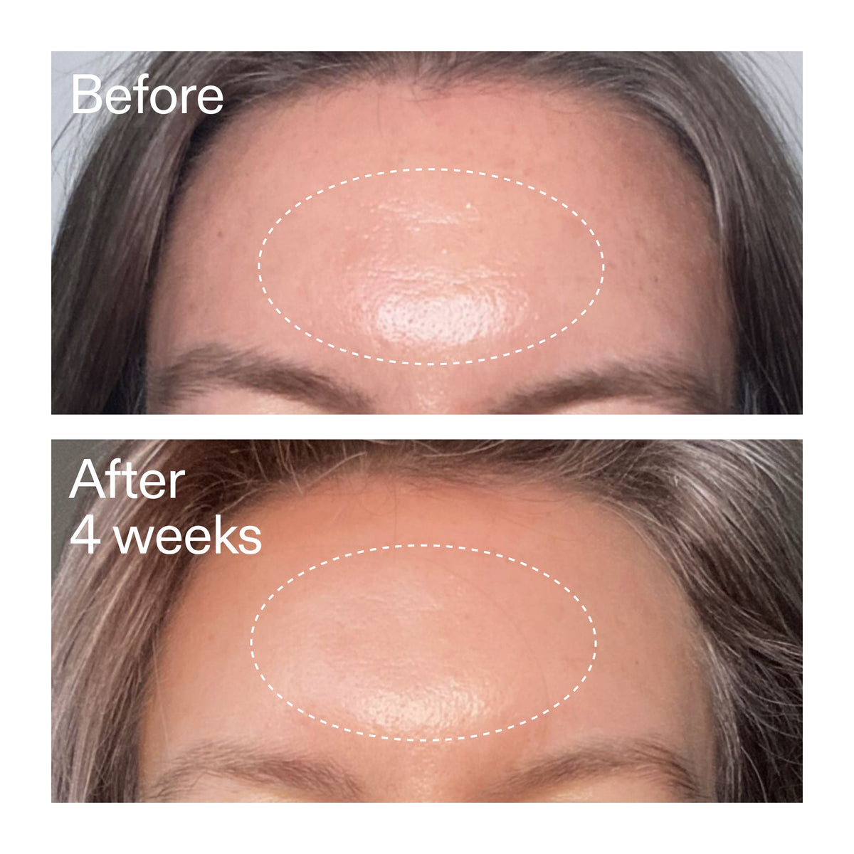 advanced-0-2-retinal-serum-x3 AdvancedRetinal_BeforeAfter1_2000x2000_1da6bb0a-29dd-41d1-95b7-8679696bbf0f.jpg