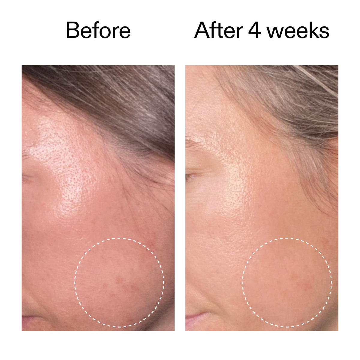 advanced-0-2-retinal-serum-x3 AdvancedRetinal_BeforeAfter2__2000x2000_62fb16bb-77ae-4d63-8500-88dbf847f4b9.jpg
