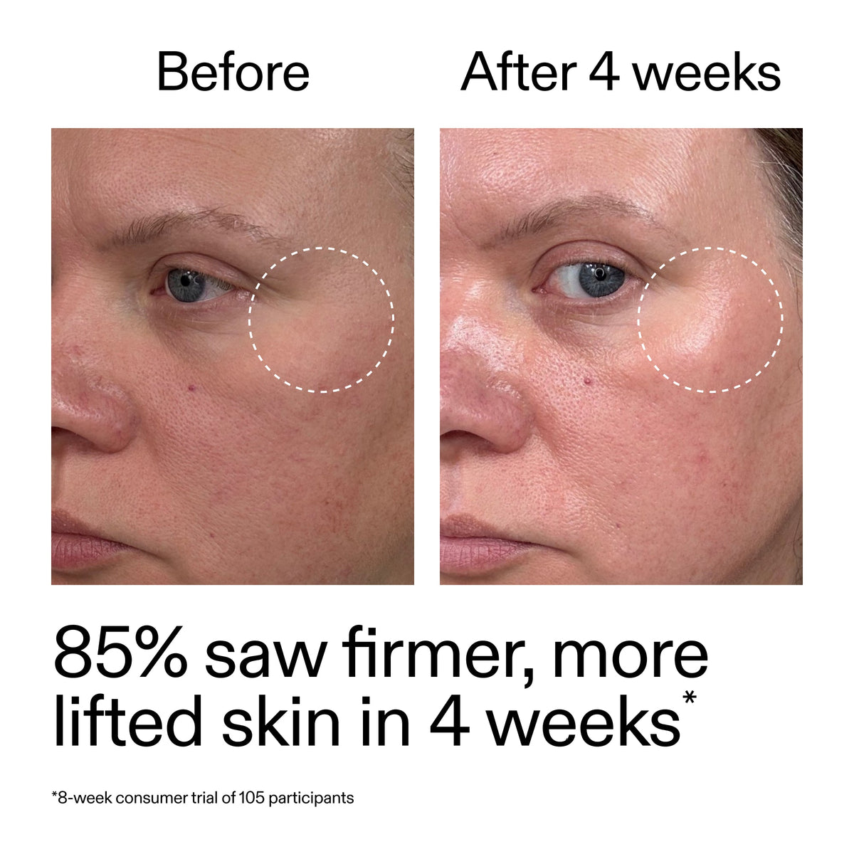 advanced-0-2-retinal-serum-x3 AdvancedRetinal_BeforeAfter_Claim1_2000x2000_bcc385c4-5e73-4f1e-aba8-64267937d0d3.jpg