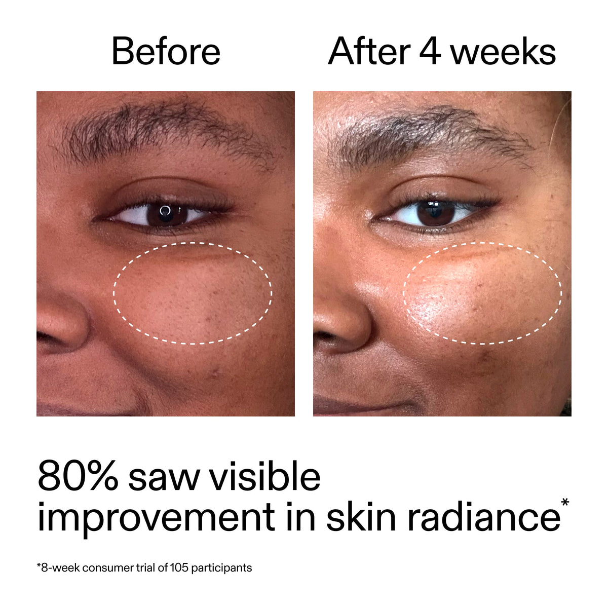 advanced-0-2-retinal-serum-x3 AdvancedRetinal_BeforeAfter_Claim2_2000x2000_39d11e3d-eda9-44ec-ab32-2903b1a368bd.jpg