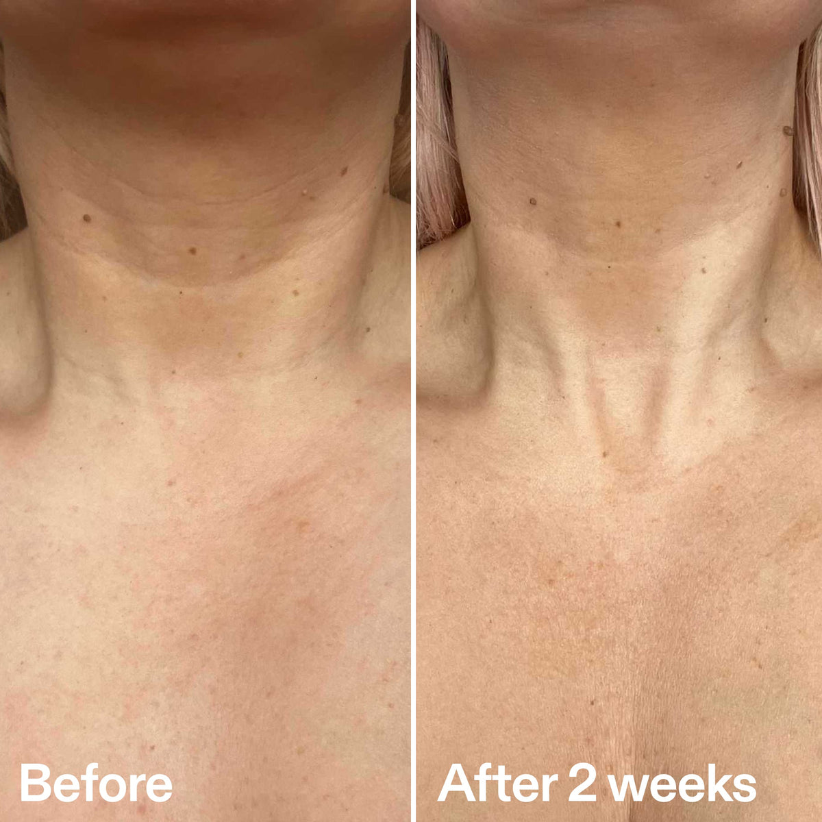 bio-active-neck-lift-stick-i4 B_A_2.jpg