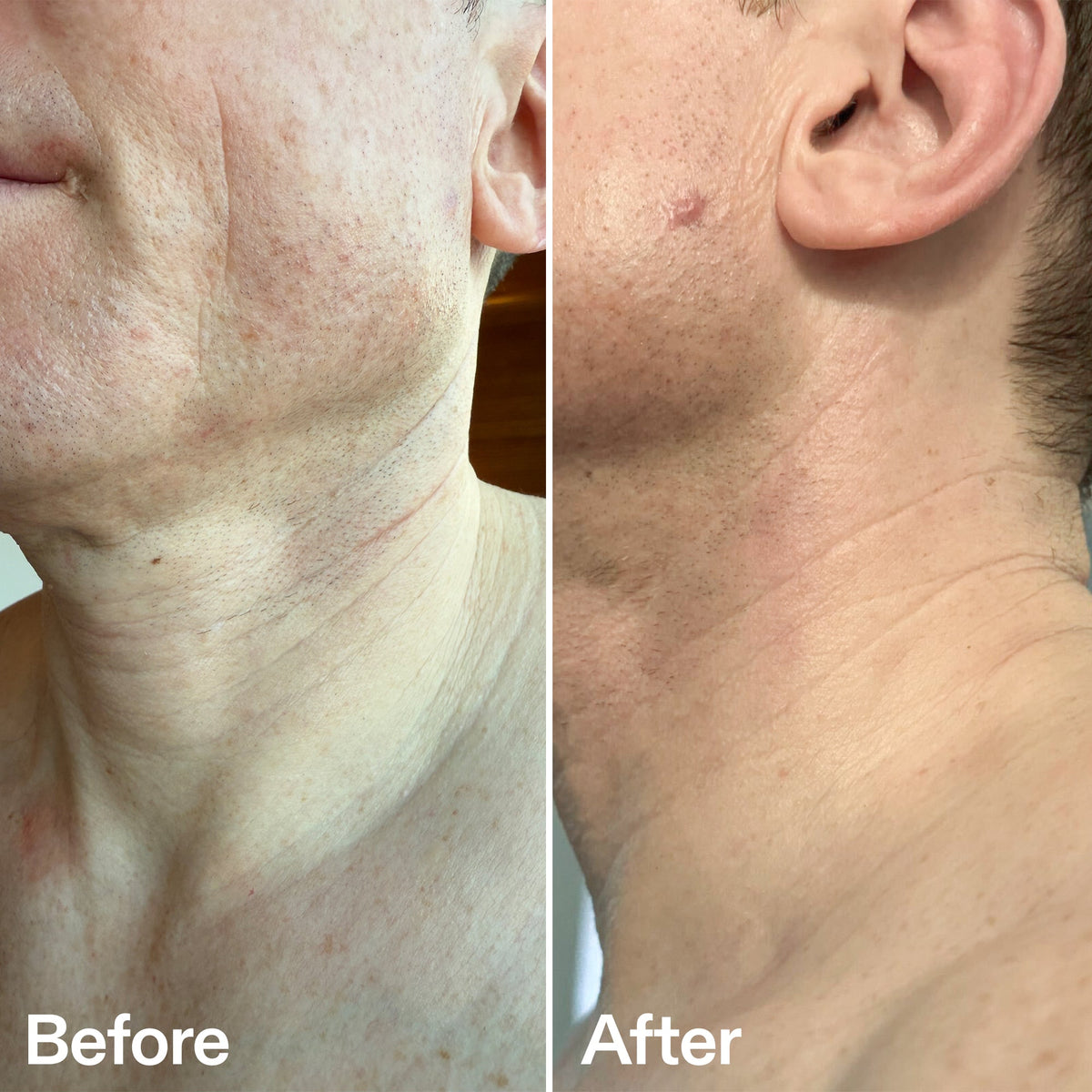 bio-active-neck-lift-stick-i4 B_A_afa2743e-b8e2-4504-92f4-e281cb6cf759.jpg
