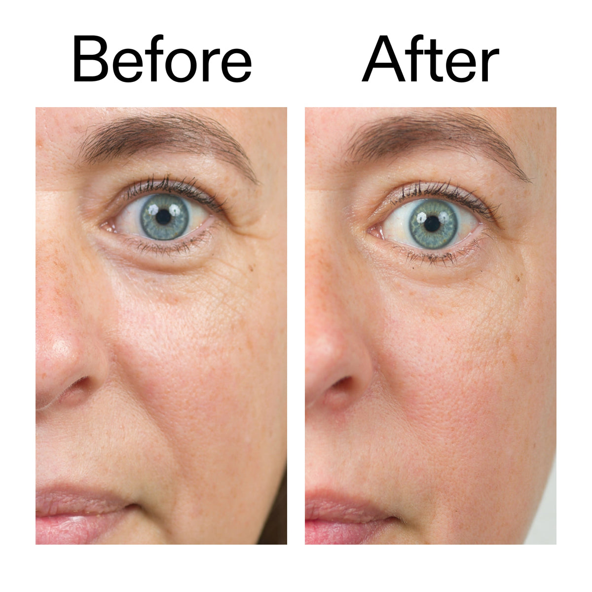 bio-active-ceramide-moisturizer-p0 Bio-Active_Before_After_2000x2000_566e5a9e-135e-417a-8242-b44e5fa35463.jpg