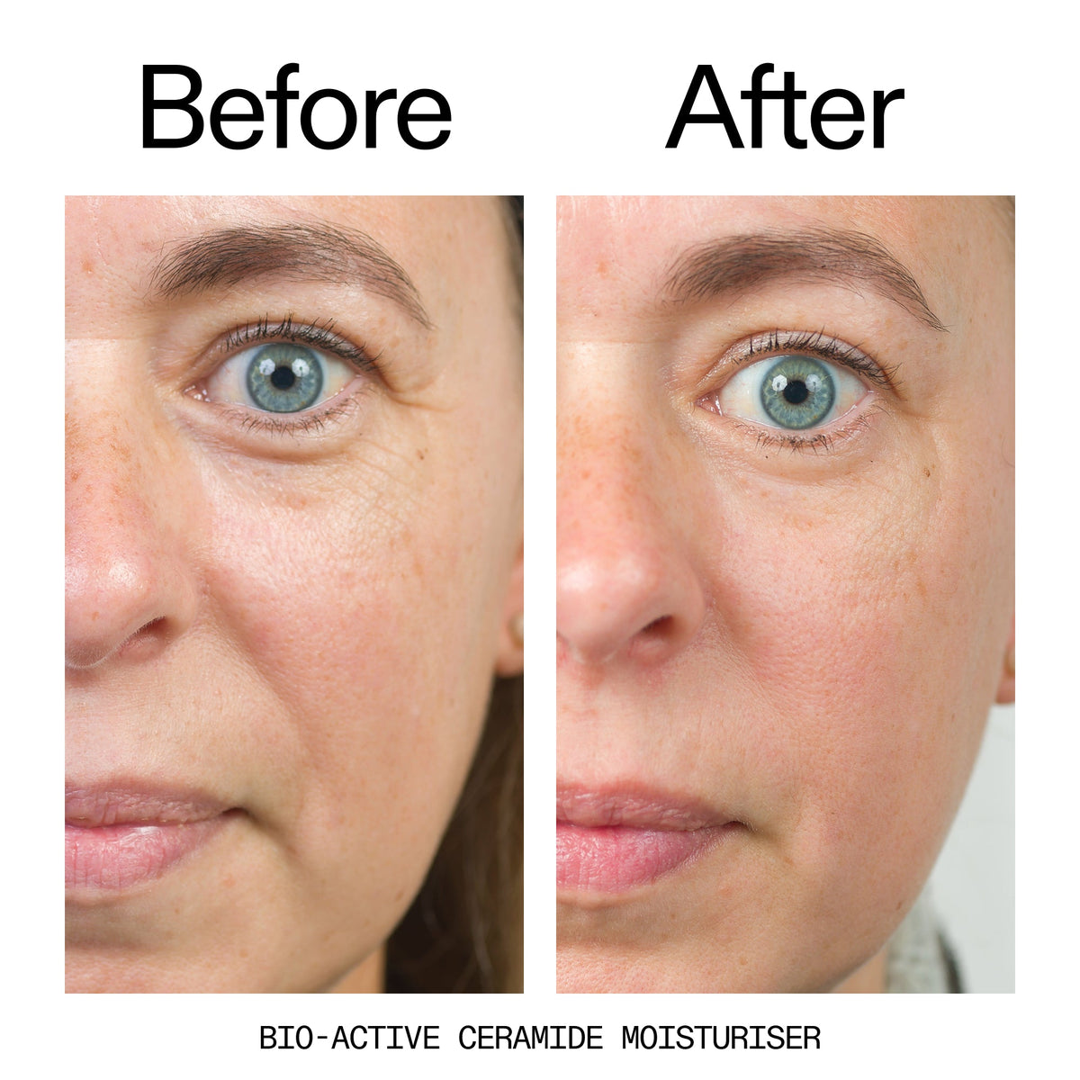 barrier-boosting-trio-n6 Bio-Active_Before_After_2000x2000_600947b4-e8c5-425a-9155-fc15bc83aa12.jpg