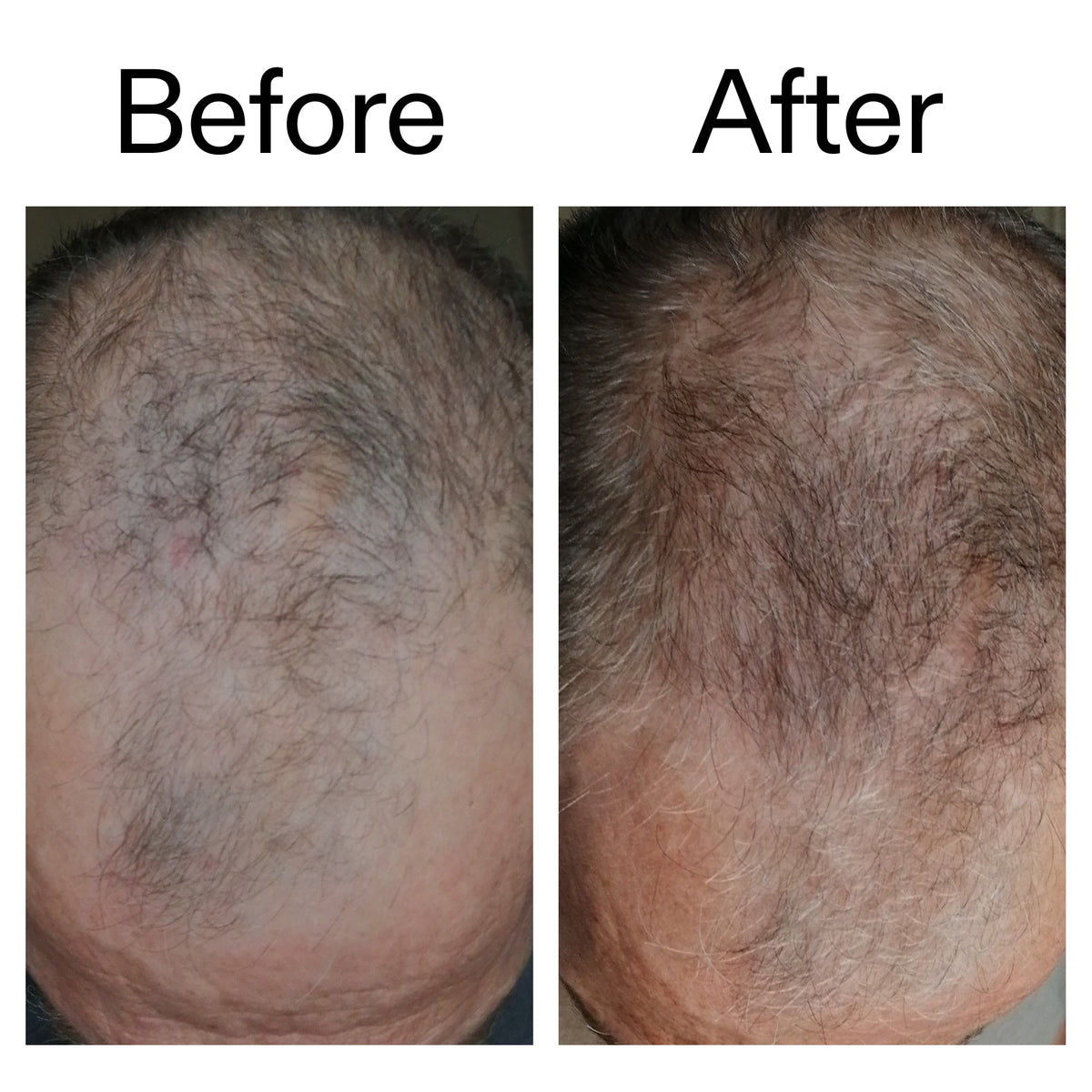 3-month-hair-growth-trio-b6 Caffeine_Scalp_Treatment_B_A_Ppage_2000_x_2000.jpg