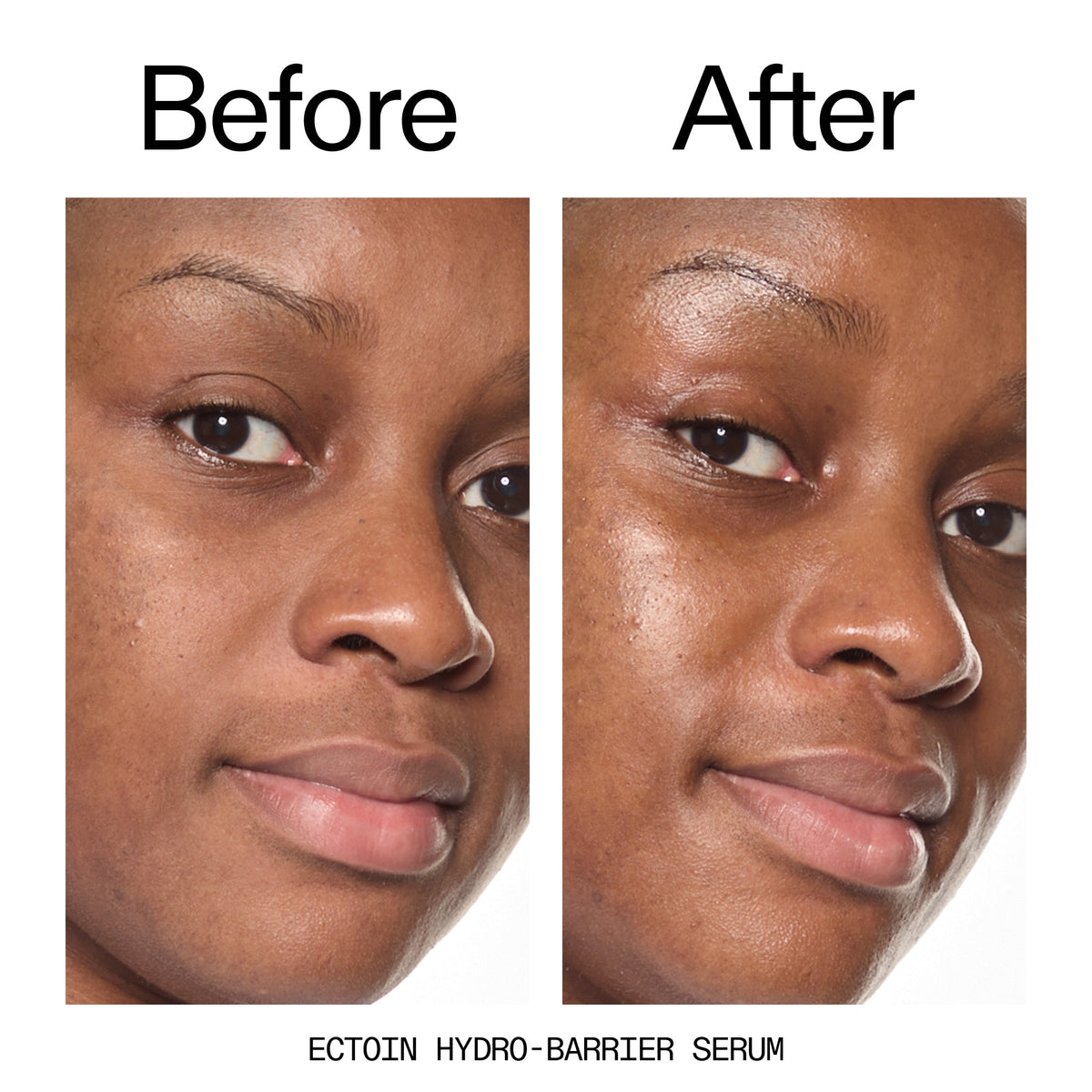 barrier-boosting-trio-n6 Ectoin_Before_After_2000x2000_ce35bc41-4da0-4b6f-adc7-29f8641f6c6c.jpg