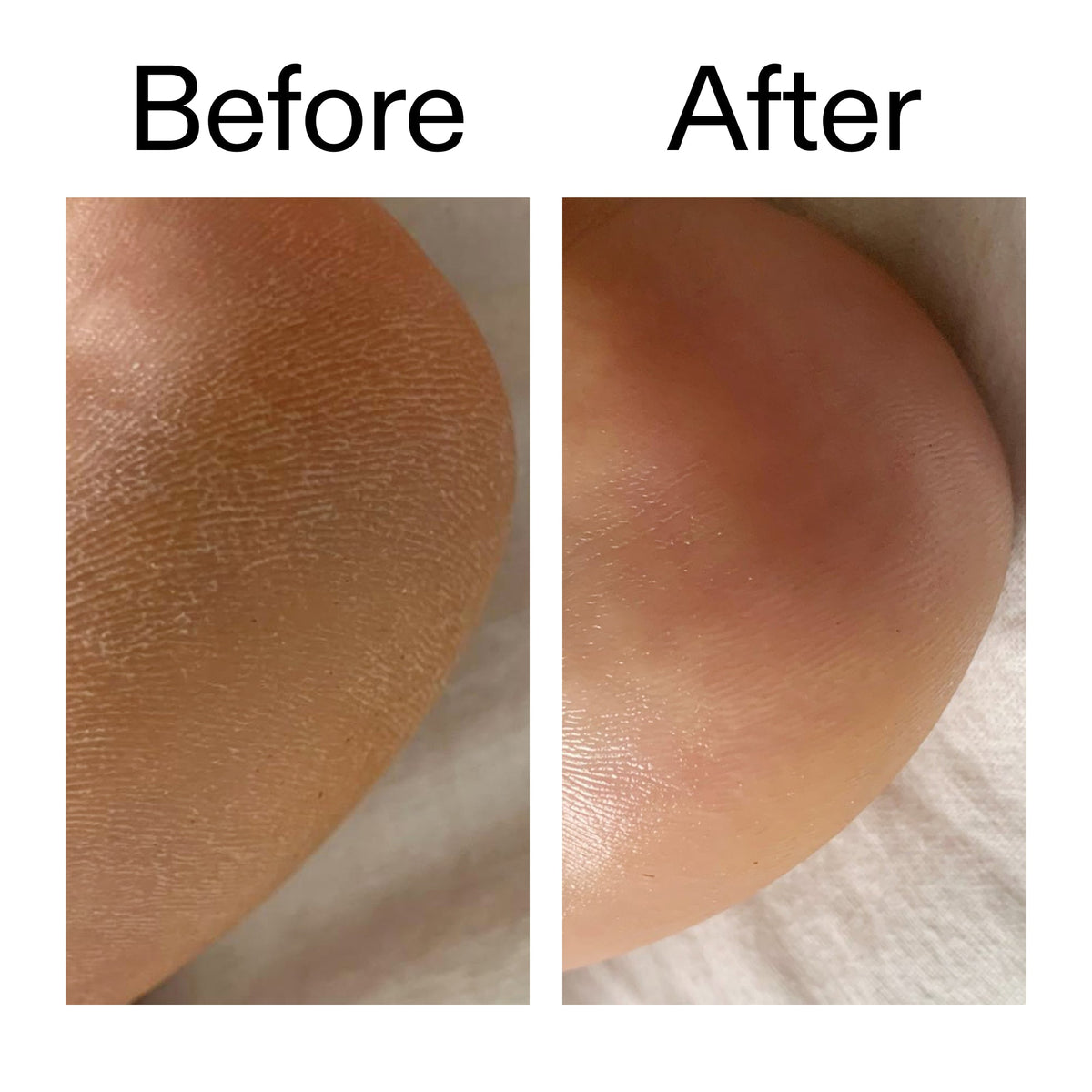 glycolic-acid-exfoliating-body-stick-duo-h4 Glycolic_Acid_Exfoliating_Body_Stick_Before_After_V1_2000x2000_a3043625-9400-429a-a7fb-d6dbd220f722.jpg