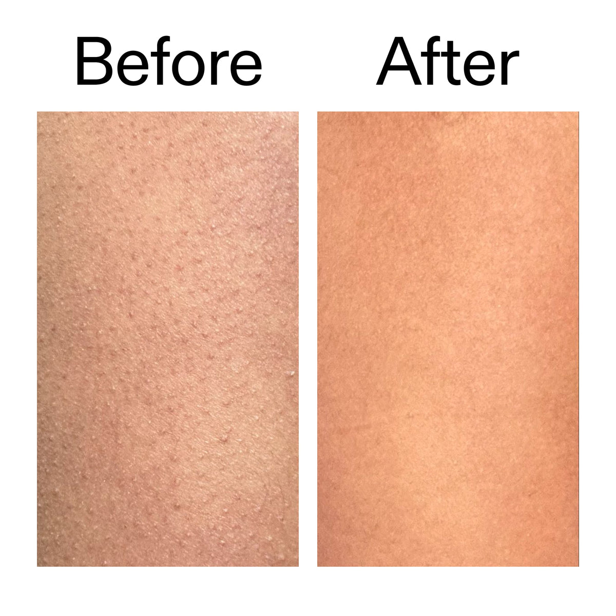 glycolic-acid-exfoliating-body-stick-duo-h4 Glycolic_Body_Stick_B_A_2000x2000_6e6e6b4d-5bd7-43c0-aeed-4d66788e8995.jpg