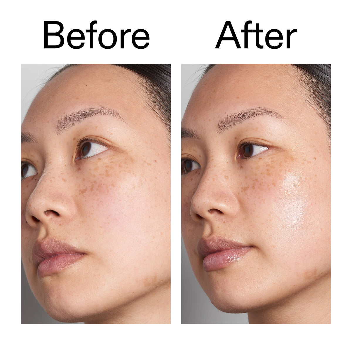 supersize-hyaluronic-acid-serum-100ml-duo-w8 Hyaluronic_Acid_Before_After_2000x2000_d7983956-8aa2-4ea3-8255-c63e8d4f892e.jpg