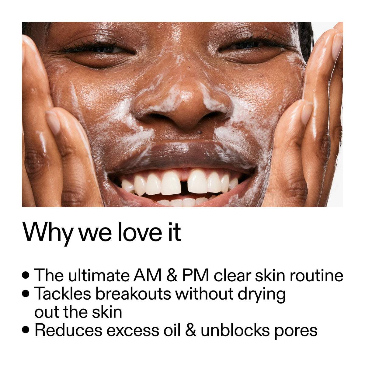 intro-routine-for-acne-j1 Intro_Routine_for_Acne_Why_we_love_it_2000x2000_42499e10-4629-4a0e-a627-7e215f4da6bc.jpg
