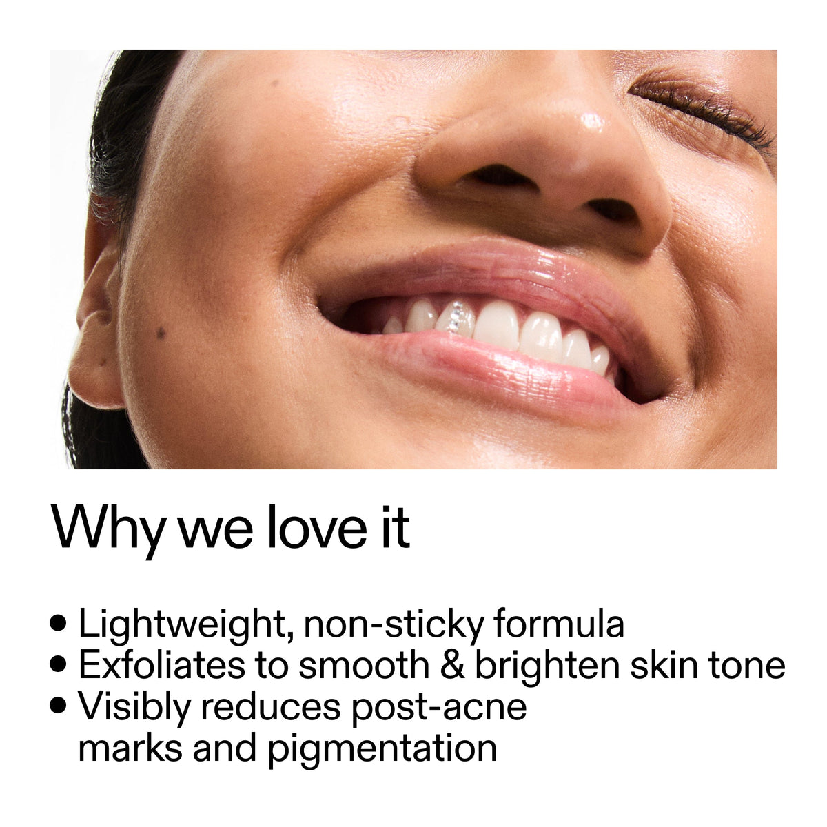 mandelic-acid-treatment-a9 Mandelic_Acid_Treatment_Why_we_love_it_2000x2000_6dfe29a9-2a79-464f-a5e8-e5ac37d93388.jpg