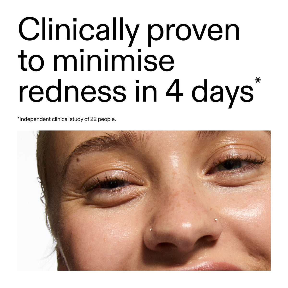 10-azelaic-acid-serum-for-redness-relief-n4 Oat_Cleansing_Balm_Claim_2000x2000_52a841dc-353c-4f2c-8646-3aadb604507d.jpg