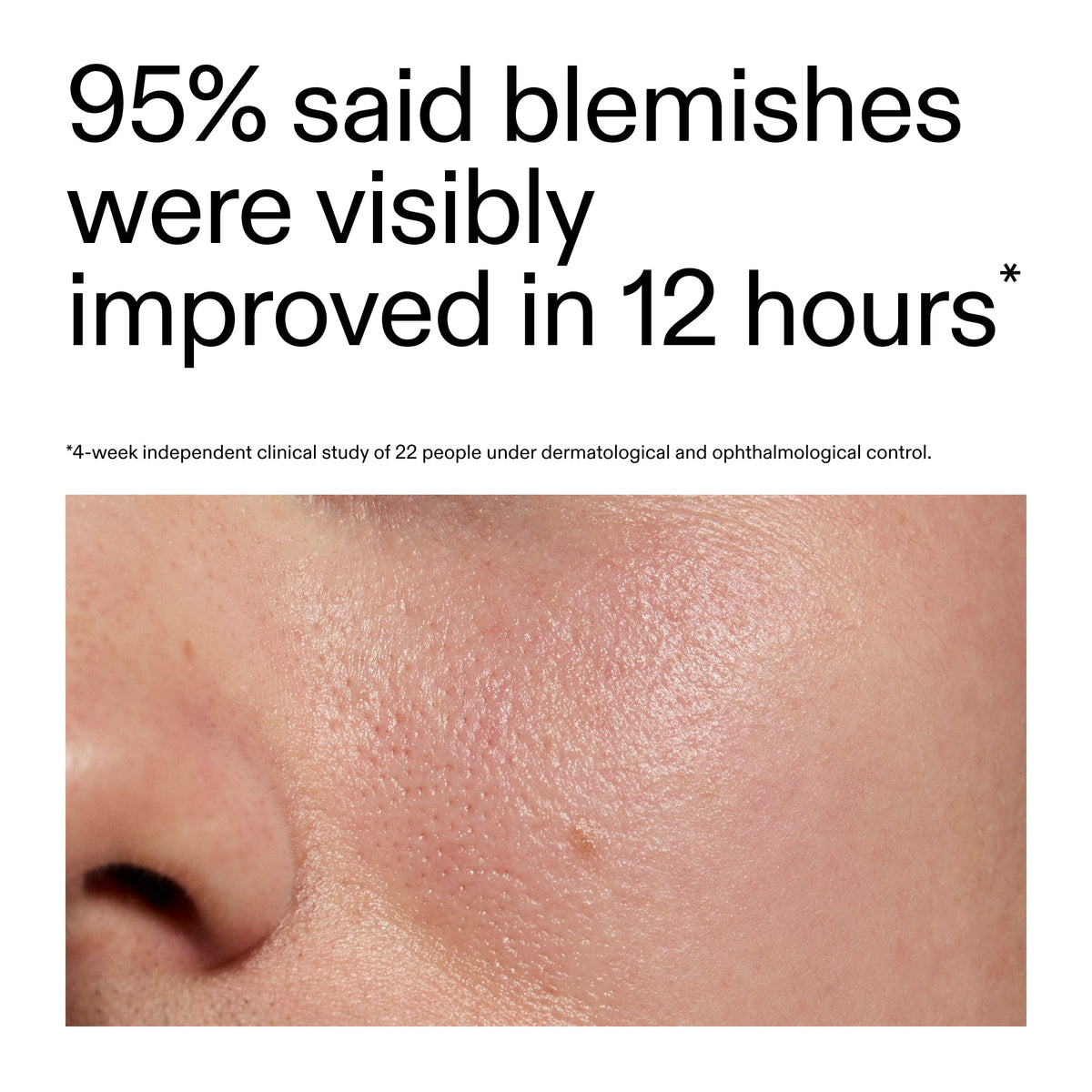 succinic-acid-acne-treatment-r4 Oat_Cleansing_Balm_Claim_2000x2000_ac6ce553-25db-41b2-a981-faae1ac4b8c0.jpg