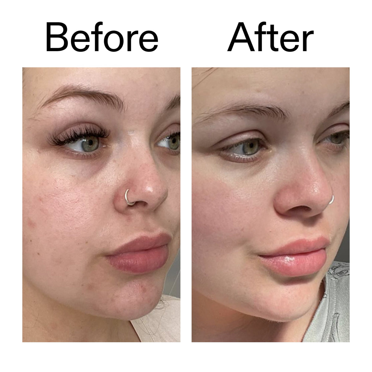 supersize-omega-water-cream-duo-l5 Omega50_Before_After_2000x2000_46483ed8-3f9d-487f-9a0c-9df79830bd65.jpg