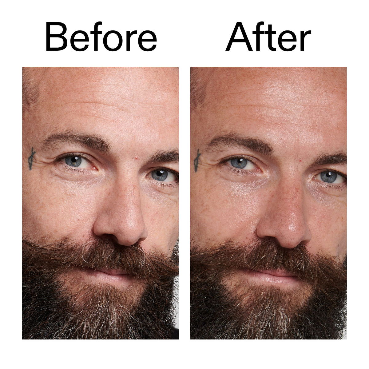 peptide-moisturizer-b3 Peptide_Moisturizer_Before_After_2000x2000_84623fe4-7b72-4f89-8e87-5edb6c752ac5.jpg