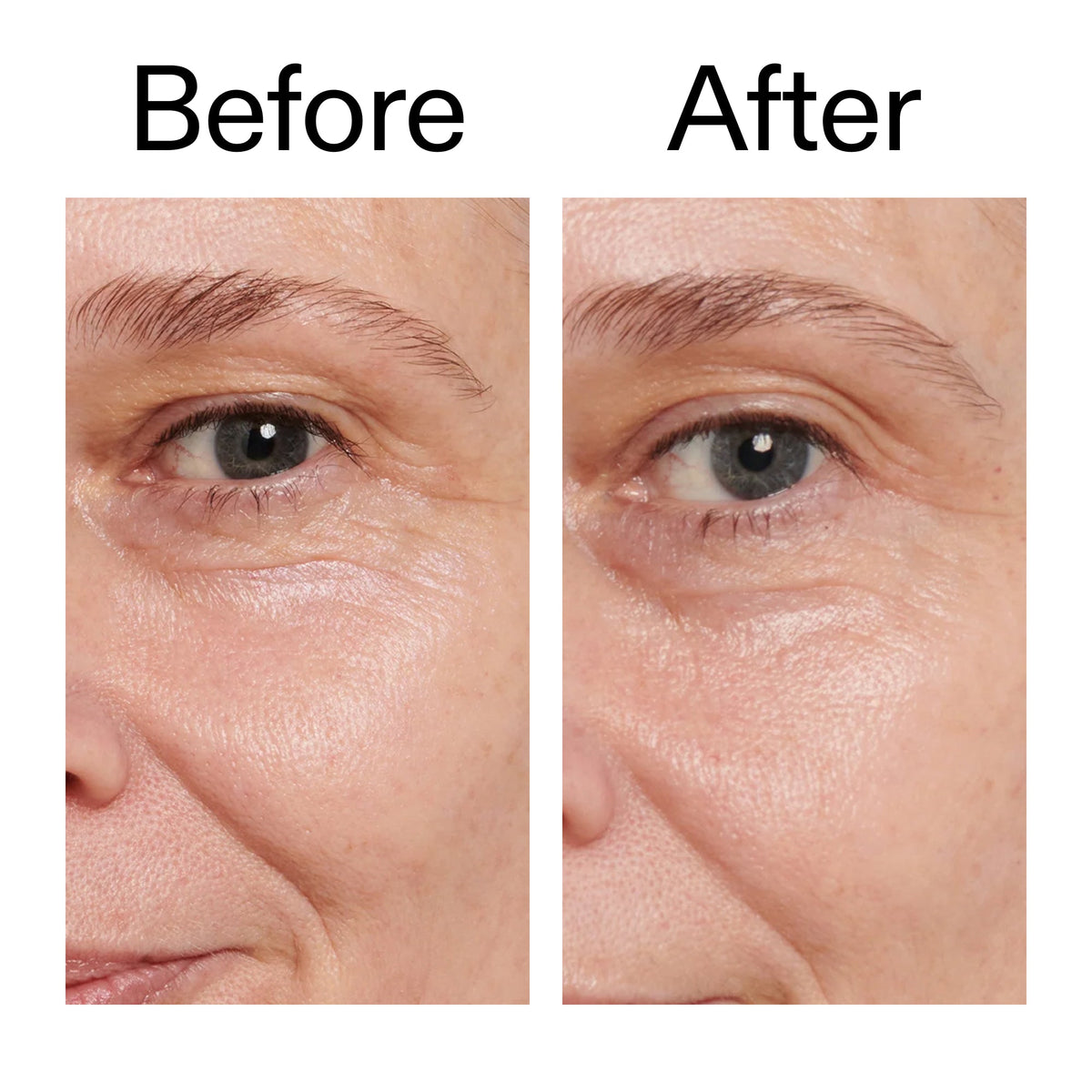retinol-eye-cream-d7 Retinol_Eye_Cream_Before_After_2000x2000_ac03a80c-109e-4572-a95a-91dc109b4d27.jpg