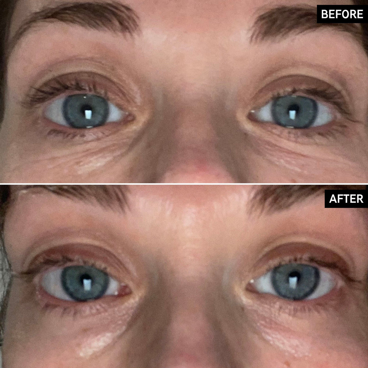 retinol-eye-cream-d7 SITE-UGCBAsApril_Nicole_B_A_PPage_2000x2000_1.jpg