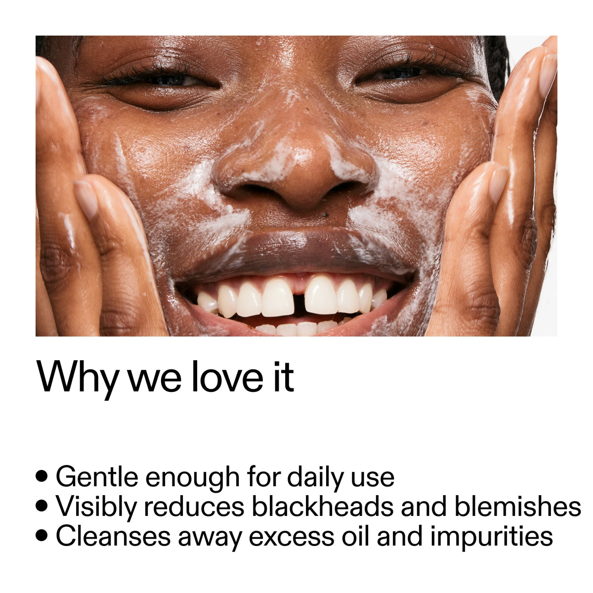 salicylic-acid-cleanser-duo-q9 Salicylic_Acid_Cleanser_-_300mlWhy_we_love_it_2000x2000_87dc92a9-2559-4309-98cd-4e570f1be735.jpg