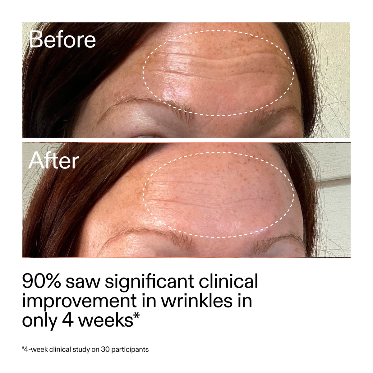 starter-retinol-serum-s6 StarterRetinol_BeforeAfter_Claim1_2000x2000_a09b50b6-4688-4527-abae-21bd142b89b7.jpg