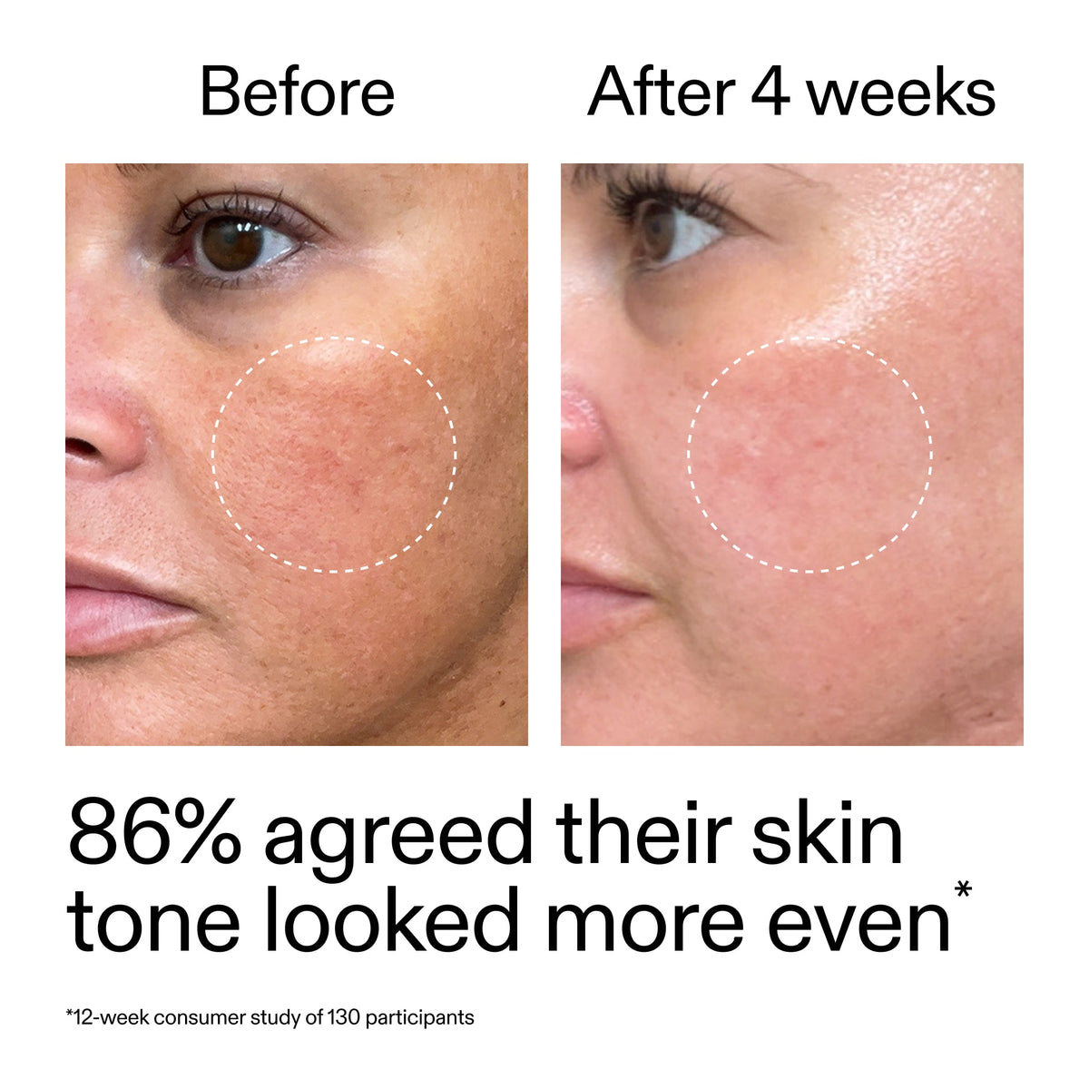 starter-retinol-serum-s6 StarterRetinol_BeforeAfter_Claim2_2000x2000_f5c9ecc0-8d76-429d-bef5-c3a61bcf5c09.jpg