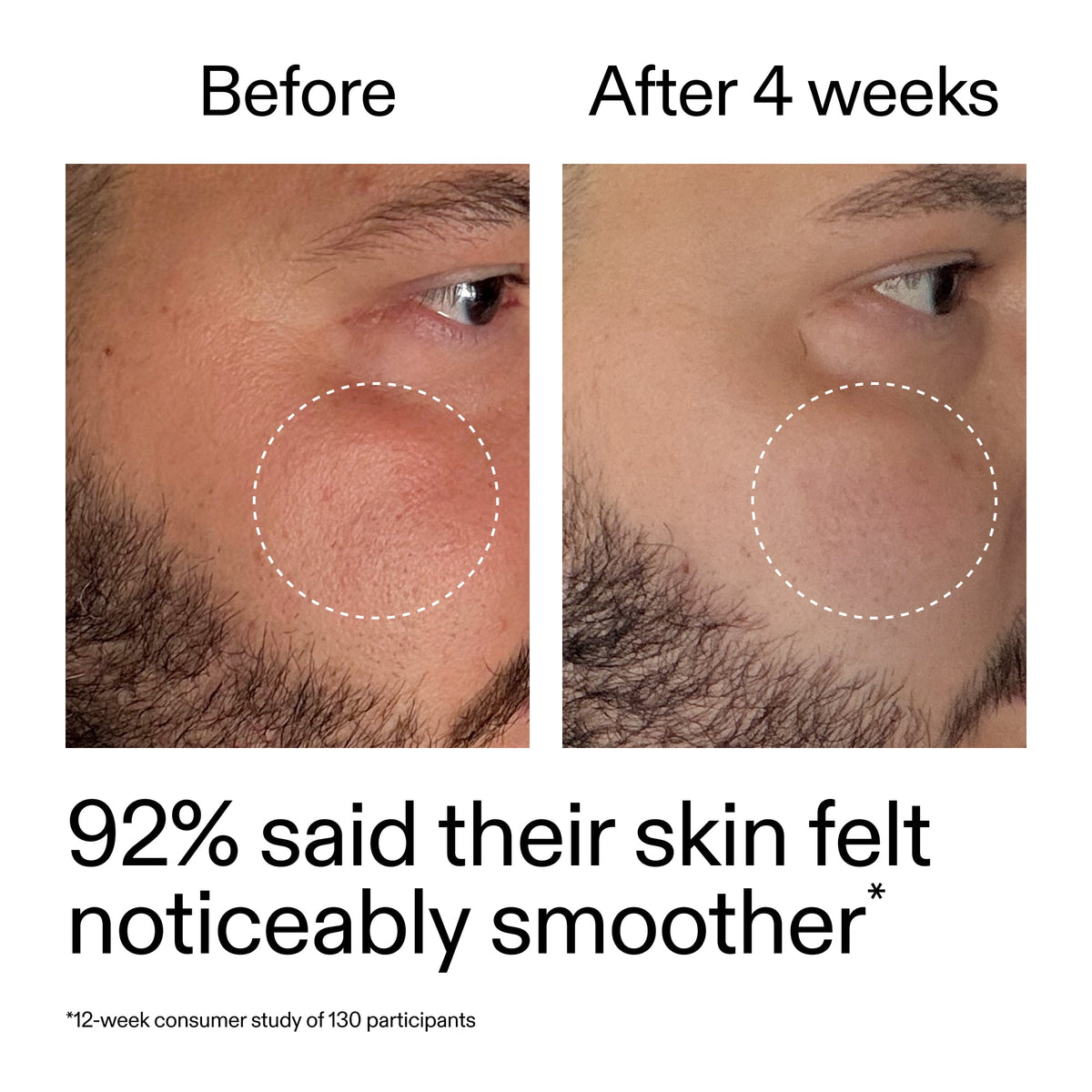 starter-retinol-serum-duo-f8 StarterRetinol_BeforeAfter_Claim3_2000x2000_458243a8-bbb0-4e5d-a274-29c7766d339b.jpg