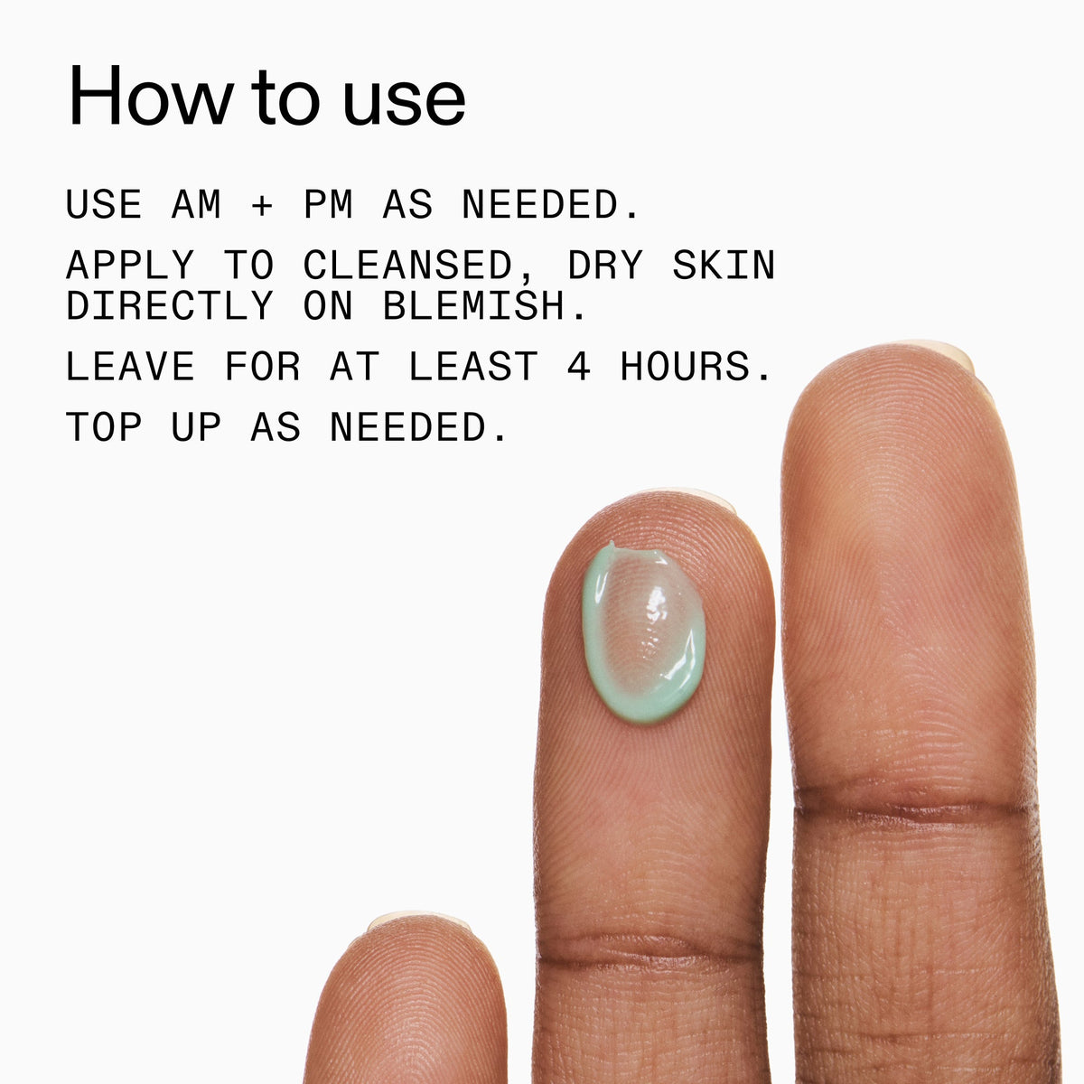 succinic-acid-acne-treatment-r4 Succinic_Acid_Treatment_How_to_Use_2000x2000_d57137d5-d7f1-427c-9a46-5fc00c19c542.jpg