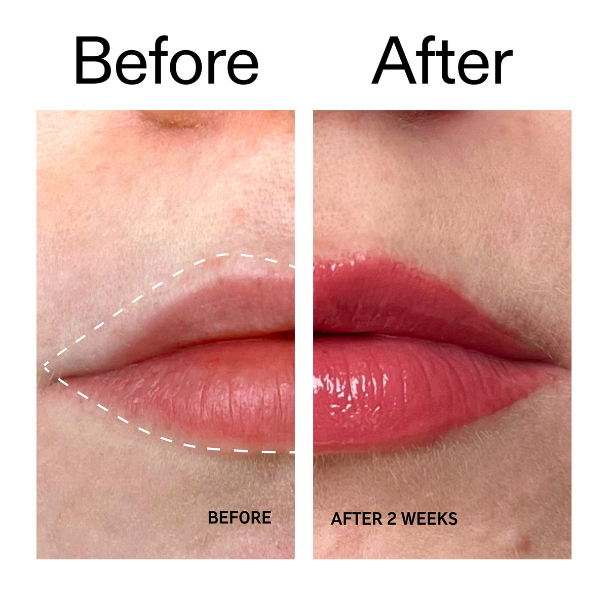 tripeptide-plumping-berry-lip-balm-v6 Tripeptide_Plumping_Lip_Balm_-_Berry_Before_After_2000x2000_9474bbd8-43ca-4b0e-b0e7-dfab70b91927.jpg