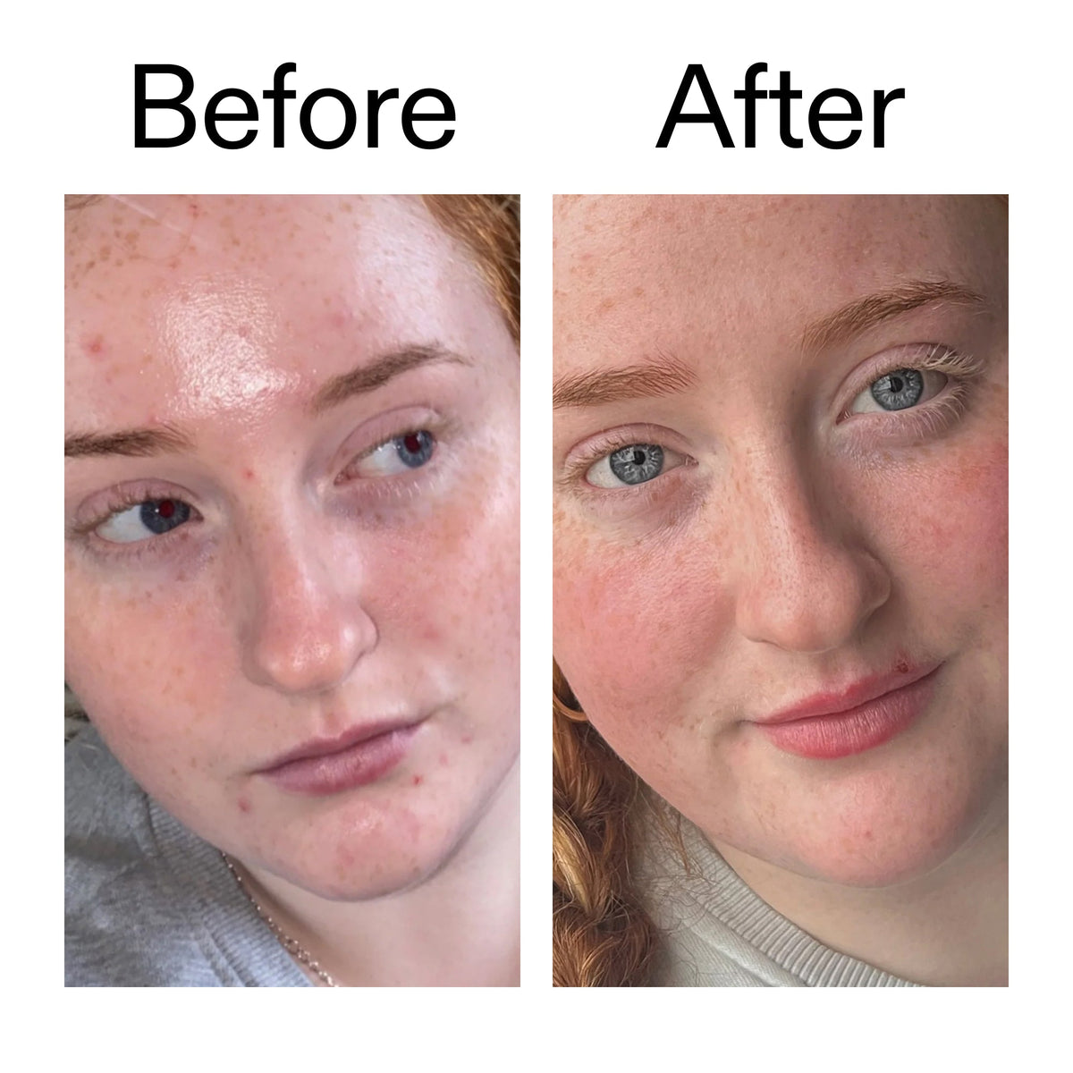 vitamin-b-c-and-e-moisturizer-y2 Vitamin_B_C_and_E_Moisturizer_Before_After_2000x2000_b0781a76-5ad2-4be9-95b8-ef92b356833c.jpg